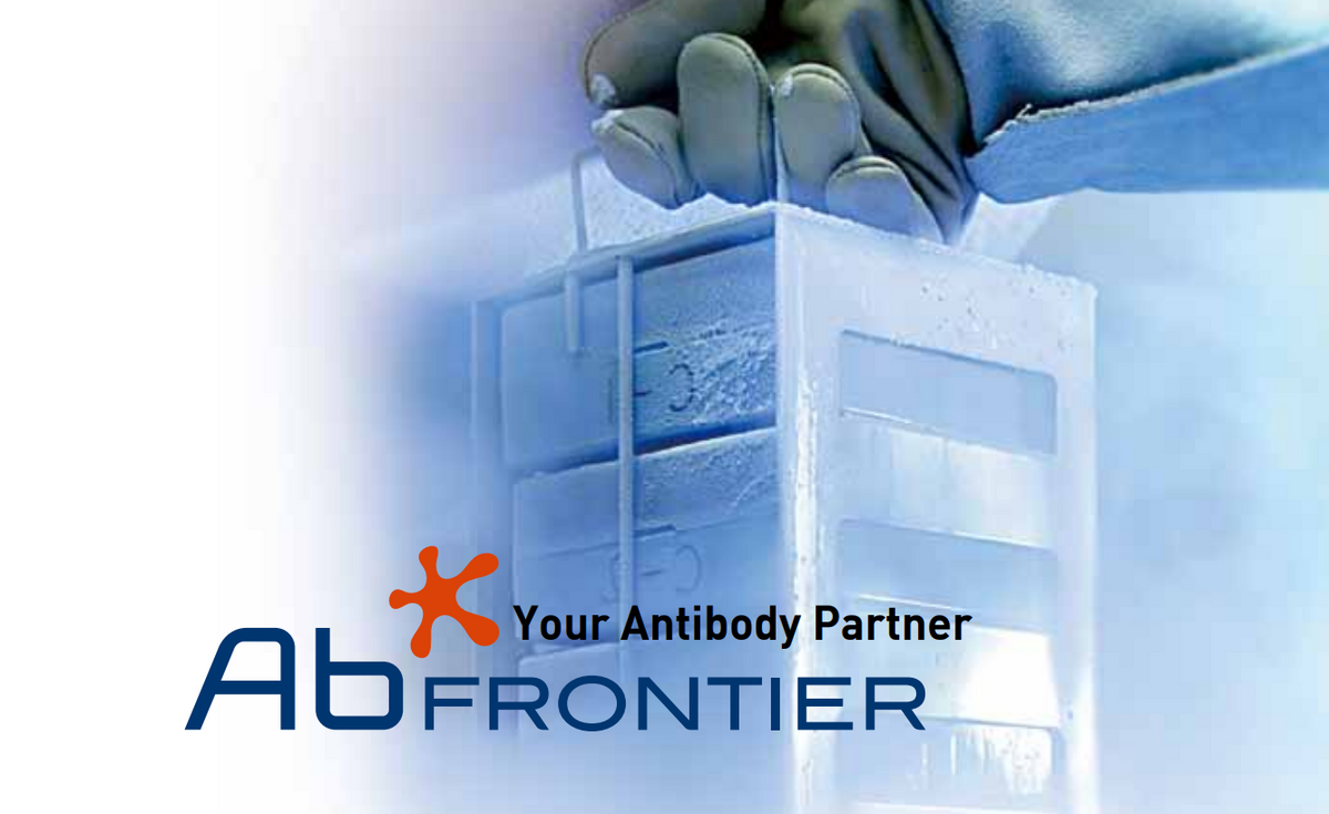 Human 14-3-3 protein gamma(YWHAG) ELISA kit, 48 test
